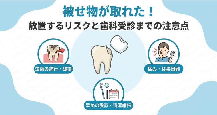 被せ物が取れた！放置するリスクと歯科受診までの注意点